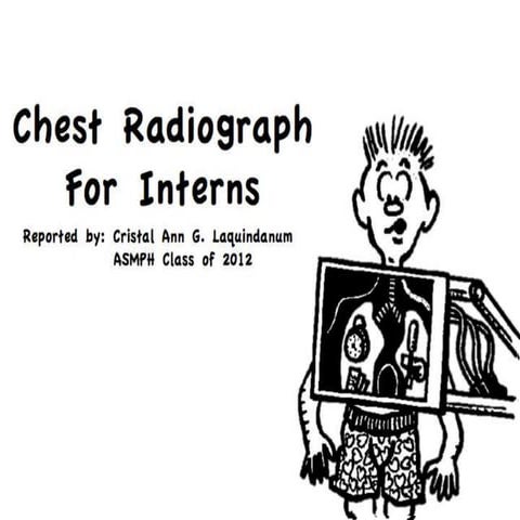 Chest Radiograph for Interns