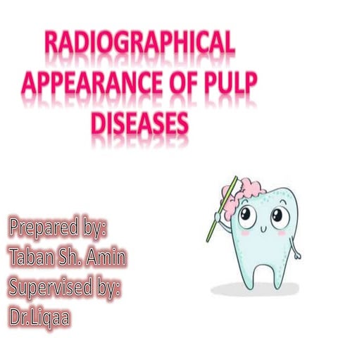 Radio pulp diseases | PPTX