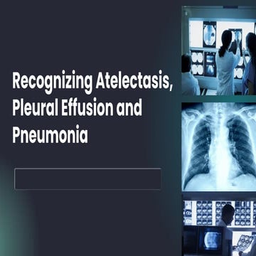 Recognizing Atelectasis, Pleural Effusion and Pneumonia