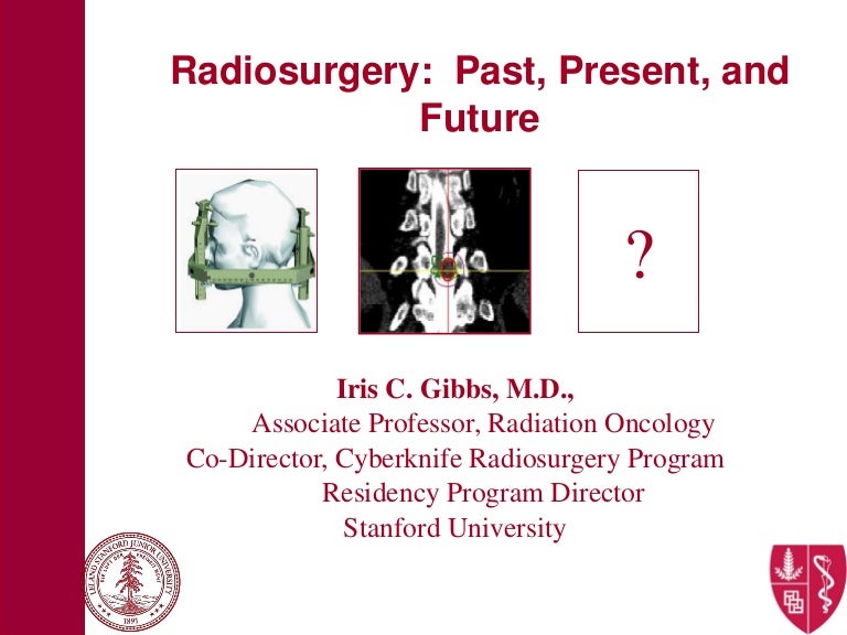 Radiosurgery