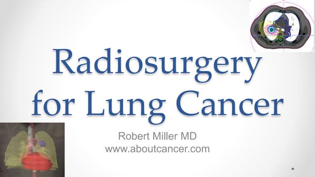 Radiosurgery for lung cancer short ...
