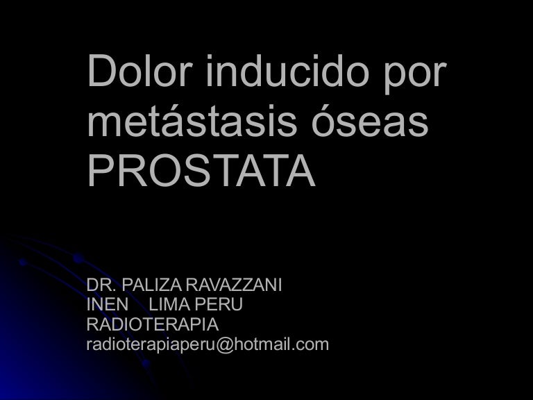 radiación de próstata en cáncer de próstata metastásico