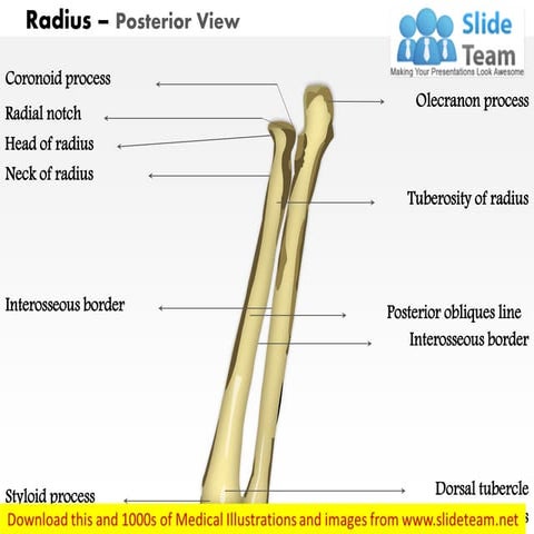 Radius posterior view medical images for power point