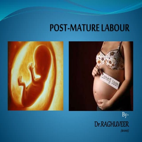 Post mature labor | PPTX
