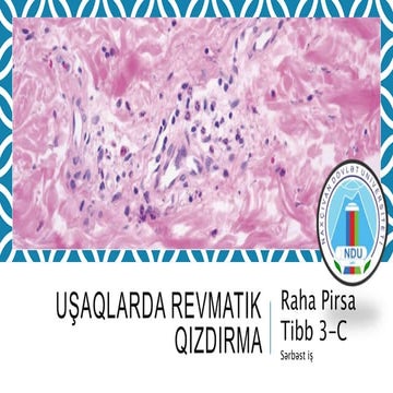 Uşaqlarda Revmatik Qızdırma. Raha Pirsa .pptx