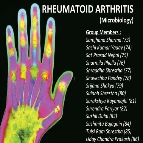 Rheumatoid Factor and Its Diagnositc Significance