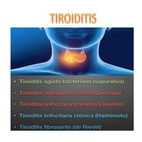 NODULO TIROIDEO Y TIROIDITIS medicina endocrinologica | PDF
