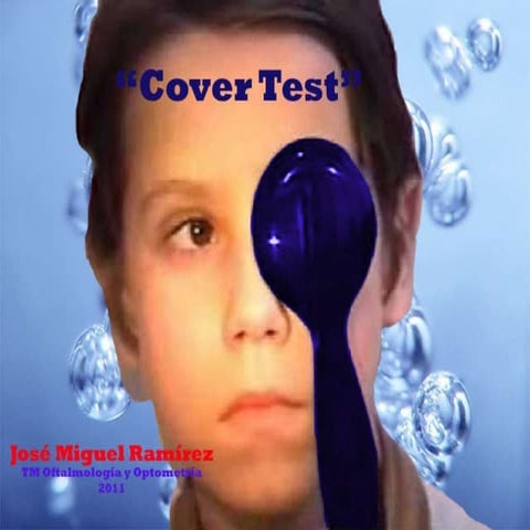Examenes de estrabismo: Cover test | PPTX