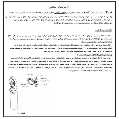 افتالموسکوپی