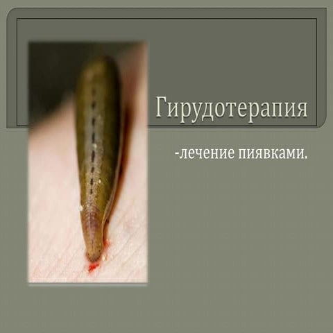 гирудотерапия | PPT