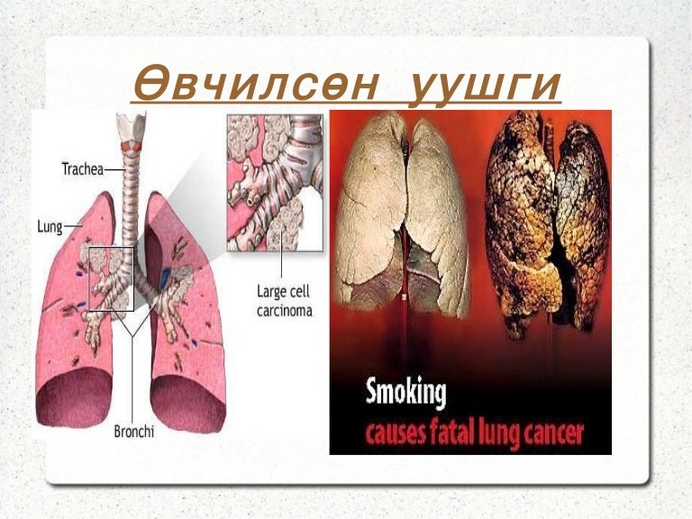 уушги