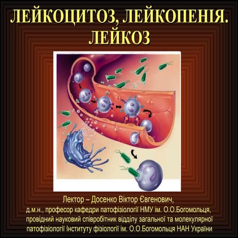 лейкоцитоз, лейкопенія, лейкоз