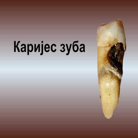 каријес зуба | PPT