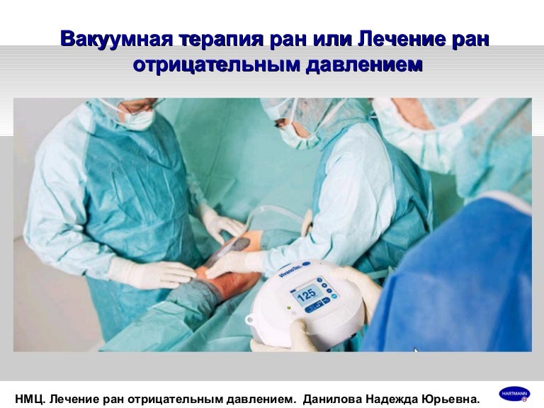 Вакуумная заправка антифриза