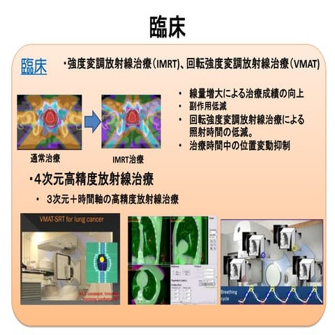 外部評価　放射線治療