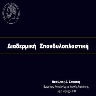 Διαδερμική Σπονδυλοπλαστική