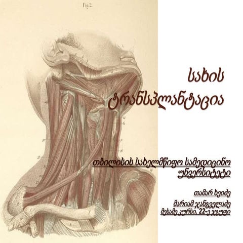 სახის ტრანსპლანტაცია