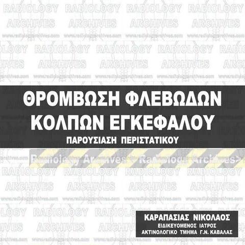 Θρόμβωση Φλεβωδών Κόλπων