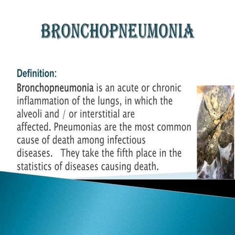 bronchopneumonia . moldova USMF
