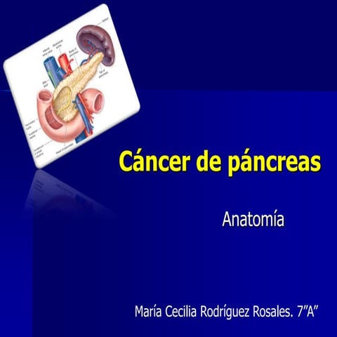 CÁNCER DE PANCREAS