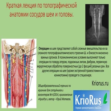 Анатомия сосудов шеи и головы - краткая лекция | PPT