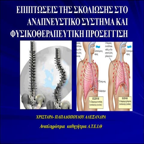 σκολιωση και αναπνευστικη λειτουργια
