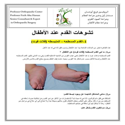 تشوهات القدم عند الاطفال - البروفيسور فريح ابوحسان - استشاري العظام في الاردن