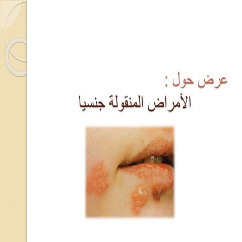 الأمراض المنقولة جنسيا