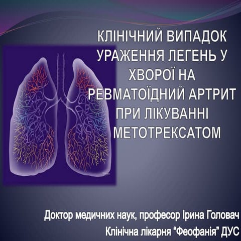 Клинический случай. Поражение легких при лечении метотрексатом больной с ревм...