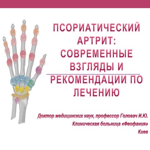 Псориатический артрит терапия. Псориатический артрит терапия. Псориатический артрит терапия. Псориатический артрит пальцев рук. Псориатический артрит лечение.