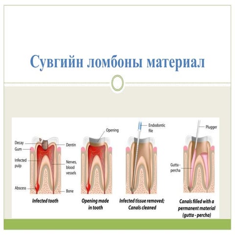 сувгийн ломбоны материал | PPT