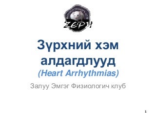 Зүрхний хэм алдагдал