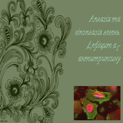 Аплазія та гіпоплазія легень. Дефіцит альфа-1-антитрипсину.