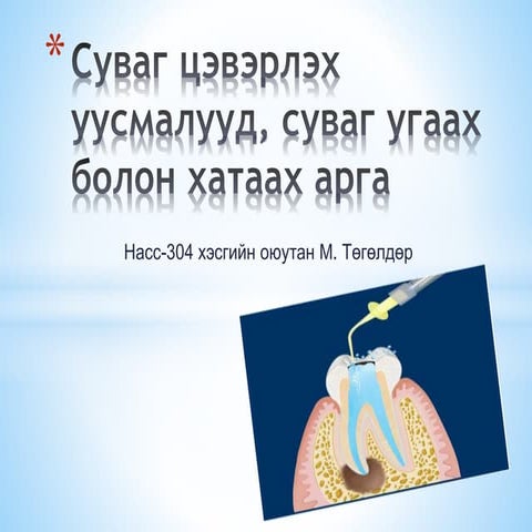 цутгуурын систем