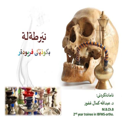 نيَرطةلة