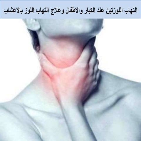 التهاب اللوزتين عند الكبار والاطفال وعلاج التهاب اللوز بالاعشاب