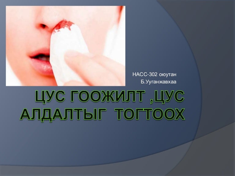 цус алдалтыг тогтоох