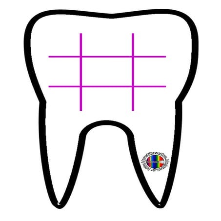 Τρίλιζα-δόντι