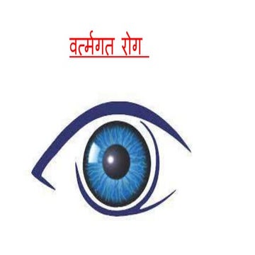 वर्त्मगत रोग.pptx