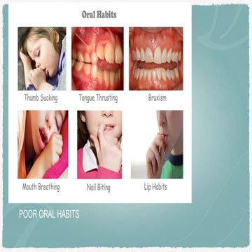 Bad oral habits | PPTX