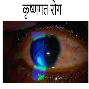 Vartmagata rogas.pptx ACCORDING TO ACHARYA SUSHRUT 21 VARTMA ROGAS AND ...