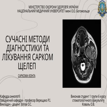 Саркома Юінга. Сучасні методи лікування та діагностики