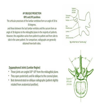 x-ray projection of spine . notes that might be useful .pptx