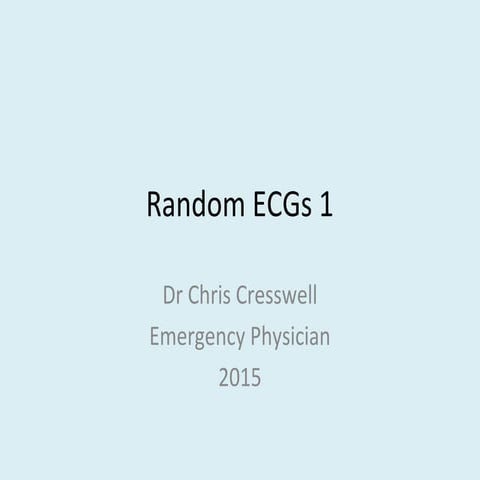 Random ECGs 1