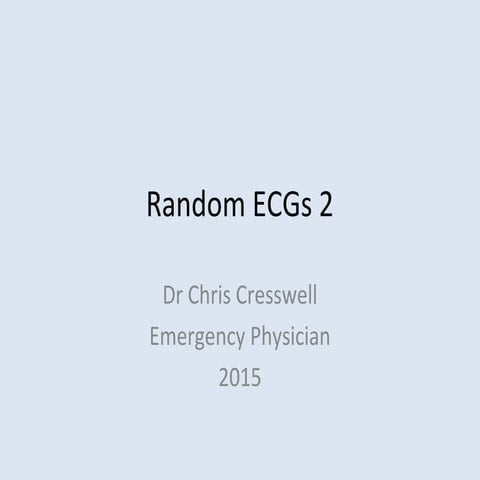 Random ECGs 2