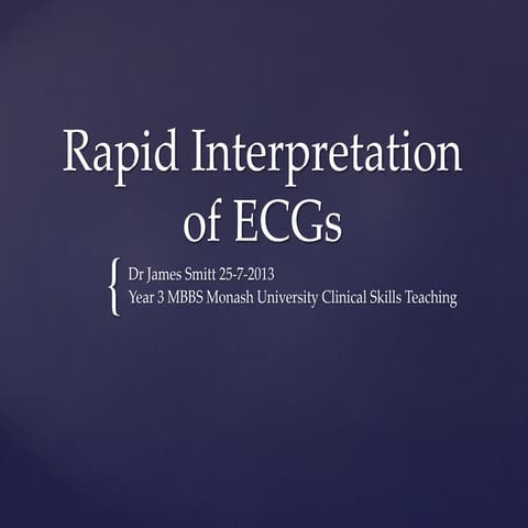 Rapid interpretation of ECG