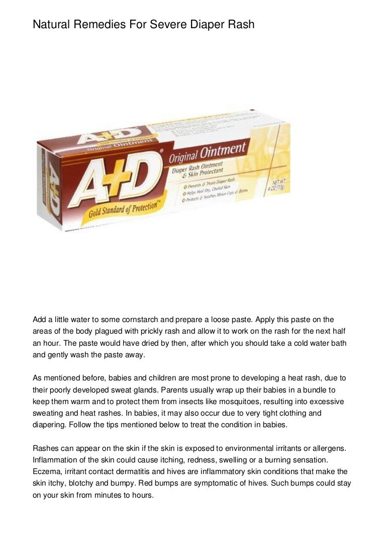 cornstarch bath for diaper rash