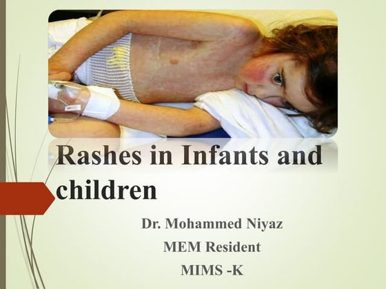 Neonatal paediatric skin diseases | PPT