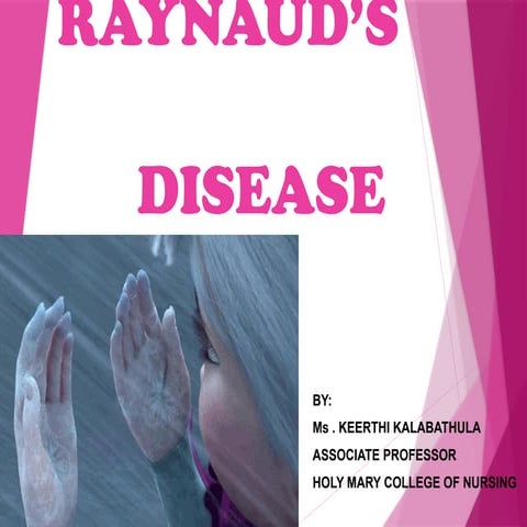 Nursing management Of patients with Raynaud's disease | PPTX