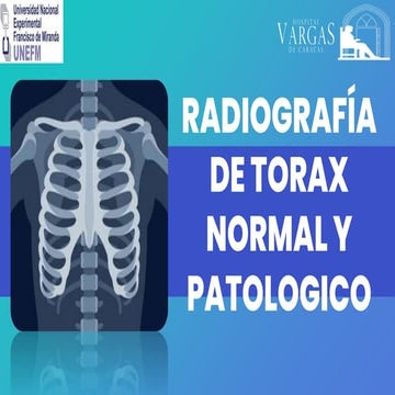 RADIOGRAFIA DE TORAX y sus generalidades.pdf